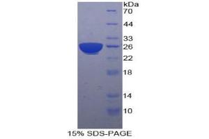 SDS-PAGE analysis of Human PSG1 Protein. (PSG1 Protein)