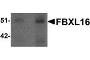 Western blot analysis of FBXL16 in human spleen tissue lysate with FBXL16 antibody at (left) 0.