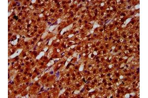 IHC image of ABIN7152082 diluted at 1:600 and staining in paraffin-embedded human adrenal gland tissue performed on a Leica BondTM system. (ETV5 Antikörper  (AA 124-265))
