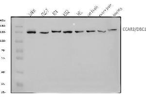 Western blot analysis of DBC-1/CCAR2 using anti-DBC-1/CCAR2 antibody (ABIN7602235).