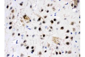 ZWINT was detected in paraffin-embedded sections of mouse brain tissues using rabbit anti- ZWINT Antigen Affinity purified polyclonal antibody (Catalog # ) at 1 µg/mL.