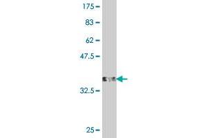 Western Blot detection against Immunogen (38. (UQCRC2 Antikörper  (AA 92-201))