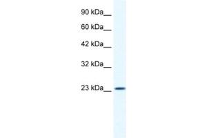 Western Blotting (WB) image for anti-Potassium Channel Tetramerisation Domain Containing 11 (KCTD11) antibody (ABIN2461421) (KCTD11 Antikörper)