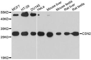 Western blot analysis of extracts of various cell lines, using CSN2 antibody. (CSN2 Antikörper)