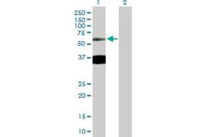 Western Blot analysis of TTBK2 expression in transfected 293T cell line by TTBK2 MaxPab polyclonal antibody. (TTBK2 Antikörper  (AA 1-478))