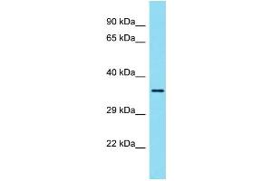 Western Blotting (WB) image for anti-Ubiquitin Thioesterase OTU1 (YOD1) (N-Term) antibody (ABIN2790891) (YOD1 Antikörper  (N-Term))