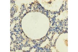 Immunohistochemistry of paraffin-embedded human lung tissue using ABIN7172870 at dilution of 1:100 (TRPM8 Antikörper  (AA 1-192))