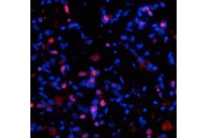 Immunostaining of fibrotic mouse lung tissue showing specific staining of collagen I  molecules (red) that are still associated with the cells in which they were synthesized. (COL1A1 Antikörper)