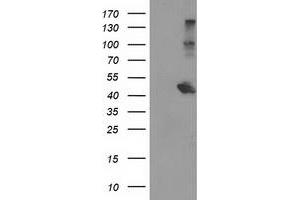 Western Blotting (WB) image for anti-Aryl Hydrocarbon Receptor Interacting Protein-Like 1 (AIPL1) antibody (ABIN1496509) (AIPL1 Antikörper)