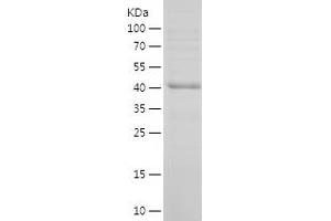 Western Blotting (WB) image for O6-Methylguanine-DNA-Methyltransferase (MGMT) (AA 1-207) protein (His-IF2DI Tag) (ABIN7124248) (MGMT Protein (AA 1-207) (His-IF2DI Tag))