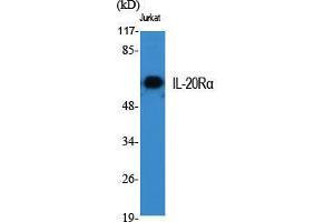 Western Blot (WB) analysis of specific cells using IL-20Ralpha Polyclonal Antibody. (IL20RA Antikörper  (Internal Region))