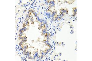 Immunohistochemistry of paraffin-embedded rat lung using SHH antibody (ABIN5975790) at dilution of 1/100 (40x lens).