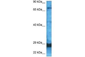 Western Blotting (WB) image for anti-F-Box and WD Repeat Domain Containing 7 (FBXW7) (C-Term) antibody (ABIN2782955)