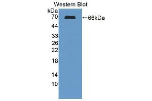 Western Blotting (WB) image for anti-Tumor Necrosis Factor Receptor Superfamily, Member 10c (TNFRSF10C) (AA 32-244) antibody (ABIN5014477)
