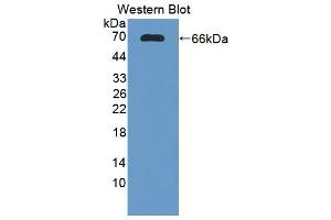 Figure. (DcR1 Antikörper  (AA 32-244))