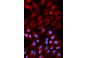 Immunofluorescence analysis of U2OS cells using PSMB2 antibody.