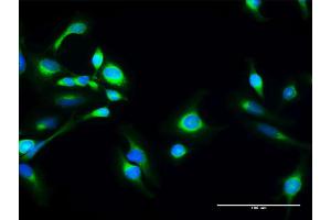 Immunofluorescence of purified MaxPab antibody to SACM1L on HeLa cell.