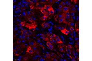 Immunofluorescence of paraffin embedded human liver using RBP (ABIN7075409) at dilution of 1: 650 (400x lens) (RBP4 Antikörper)