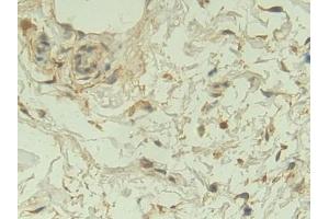 Immunohistochemistry (IHC) image for anti-Neuropilin 1 (NRP1) (AA 646-814) antibody (ABIN7432400)