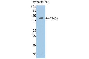 Western Blotting (WB) image for anti-Complement Factor B (CFB) (AA 35-160) antibody (ABIN1858372) (Complement Factor B Antikörper  (AA 35-160))