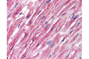 Anti-Alpha Tubulin antibody IHC of human heart.