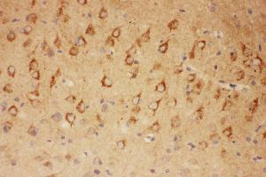 Anti-CNTF Picoband antibody,  IHC(P): Rat Brain Tissue (CNTF Antikörper  (AA 2-200))