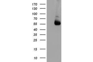 Western Blotting (WB) image for anti-Asparagine-Linked Glycosylation 2, alpha-1,3-Mannosyltransferase Homolog (ALG2) antibody (ABIN1496609) (ALG2 Antikörper)