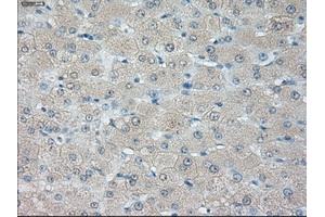 Immunohistochemical staining of paraffin-embedded liver tissue using anti-HSD17B10 mouse monoclonal antibody. (HSD17B10 Antikörper)