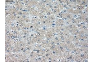 Immunohistochemical staining of paraffin-embedded liver tissue using anti-HSD17B10 mouse monoclonal antibody. (HSD17B10 Antikörper)