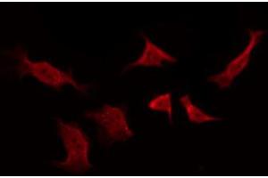 ABIN6267260 staining SK-OV3 by IF/ICC. (EGFR Antikörper  (pTyr1016))
