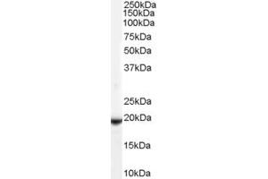 Western Blotting (WB) image for anti-Cadherin 8 (CDH8) (N-Term) antibody (ABIN2782141) (Cadherin 8 Antikörper  (N-Term))