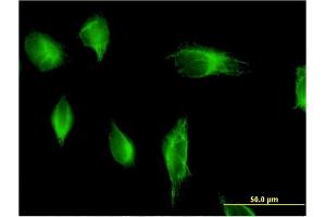 Immunofluorescence of monoclonal antibody to PIK3C2A on HeLa cell. (PIK3C2A Antikörper  (AA 1577-1686))