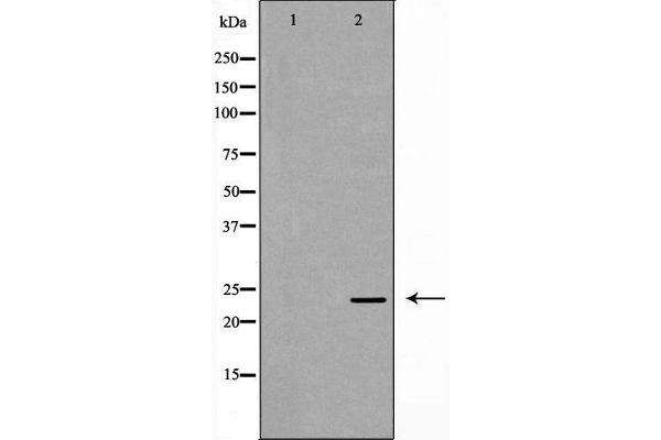 Ephrin A1 Antikörper  (Internal Region)