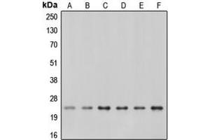 Western blot analysis of Caveolin 1 expression in A549 (A), A431 (B), NIH3T3 (C), mouse kidney (D), rat kidney (E), rat heart (F) whole cell lysates. (Caveolin-1 Antikörper  (C-Term))