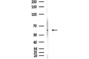 Western blot analysis of lysates from Hela cells(heat-shock,45 min treatment), using PKM2 Antibody at 1/1000 dilution.