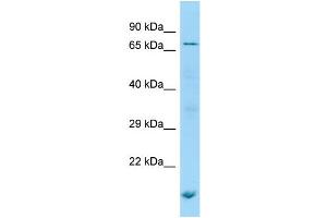 WB Suggested Anti-POF1B Antibody Titration: 1. (POF1B Antikörper  (N-Term))