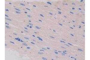 Used in DAB staining on fromalin fixed paraffin- embedded testis tissue (IL13 Receptor alpha 1 Antikörper  (AA 201-360))