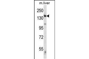 Western Blotting (WB) image for anti-Eukaryotic Translation Initiation Factor 2 alpha Kinase 4 (EIF2AK4) (AA 1477-1504), (C-Term) antibody (ABIN5531092)
