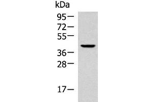 Western blot analysis of 293T cell lysate using KLF6 Polyclonal Antibody at dilution of 1:800 (KLF6 Antikörper)