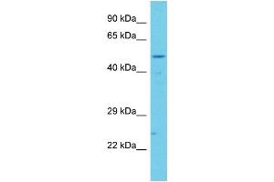 Host: Rabbit Target Name: CCDC41 Sample Type: Jurkat Whole Cell lysates Antibody Dilution: 1. (CCDC41 Antikörper  (C-Term))