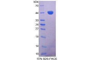 SDS-PAGE (SDS) image for Gastrin (GAST) (AA 22-104) protein (His tag,GST tag) (ABIN4988633)