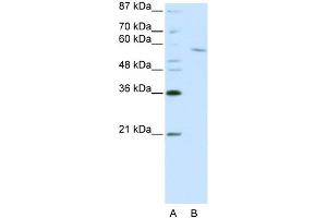 WB Suggested Anti-RCOR1 Antibody Titration:  0. (CoREST Antikörper  (C-Term))