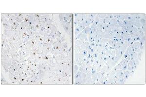 Immunohistochemical analysis of paraffin-embedded human heart tissue, using Bloom Syndrome Protein (Phospho-Thr99) antibody (left)or the same antibody preincubated with blocking peptide (right). (BLM Antikörper  (pThr99))