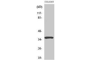 Western Blotting (WB) image for anti-Ras Association (RalGDS/AF-6) Domain Family Member 4 (RASSF4) (Internal Region) antibody (ABIN3186696)