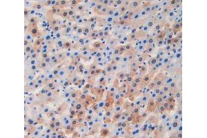 IHC-P analysis of liver tissue, with DAB staining. (LCAT Antikörper  (AA 290-434))