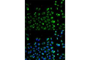 Immunofluorescence (IF) image for anti-Autophagy Related 13 (ATG13) (AA 281-480) antibody (ABIN3021088)