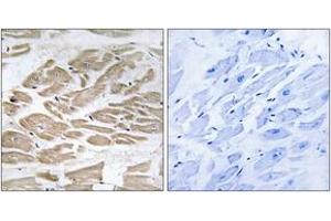 Immunohistochemistry (IHC) image for anti-Brain Protein 44-Like (BRP44L) (AA 11-60) antibody (ABIN2890168) (BRP44L Antikörper  (AA 11-60))