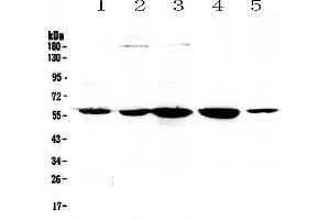 ETV6 Antikörper  (AA 327-448)
