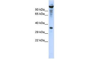 Western Blotting (WB) image for anti-Ribonuclease T2 (RNASET2) antibody (ABIN2458003) (RNASET2 Antikörper)