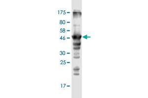Western Blot detection against Immunogen (47. (MRPL12 Antikörper  (AA 1-198))